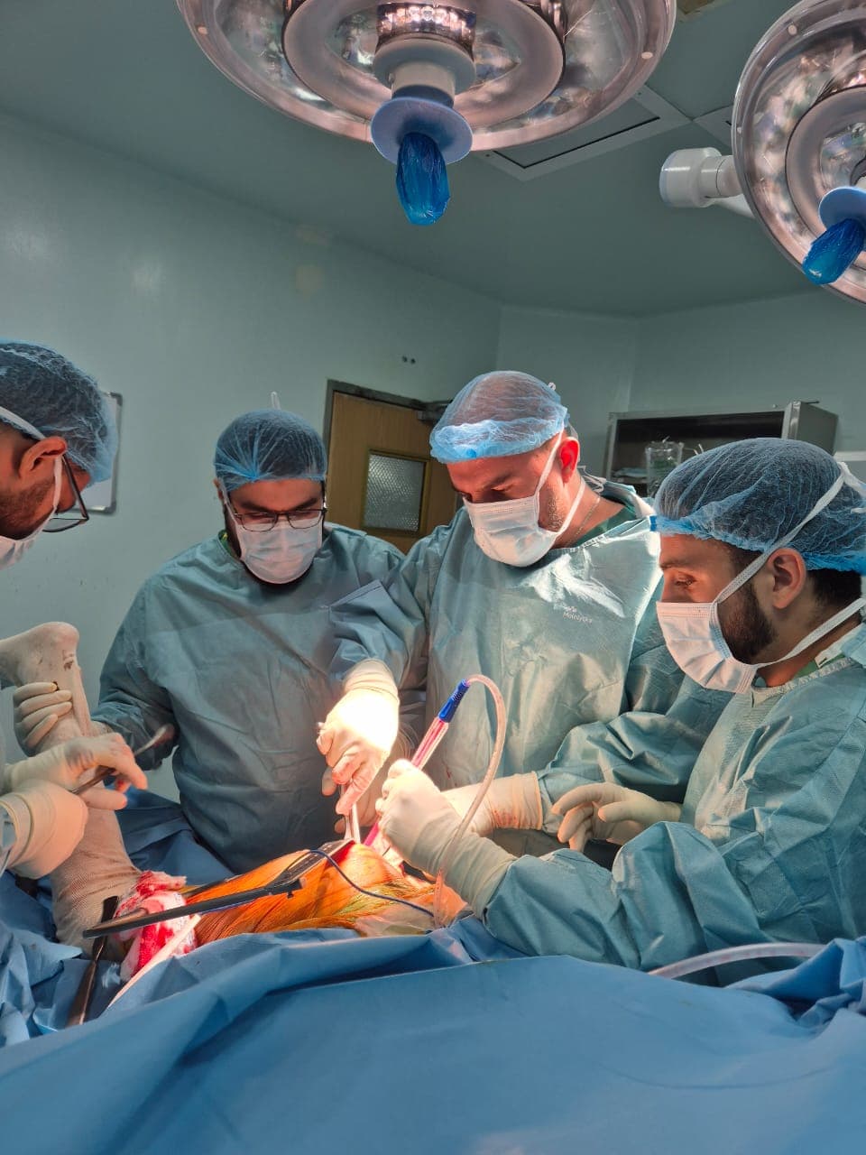 Meniscus Tears — Repair vs Removal